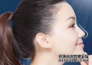 韩式隆鼻手术有哪些特点