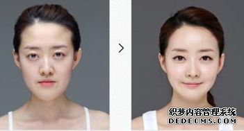 反颌如何矫治好